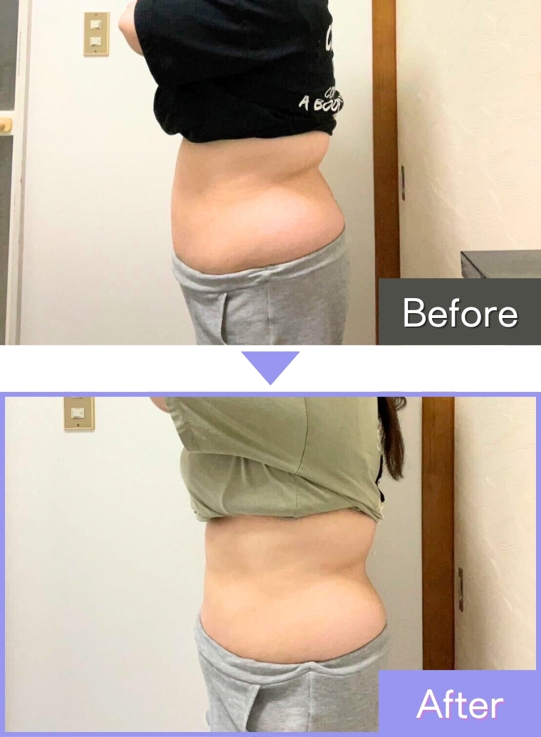 IEDEMOダイエット実施後の写真