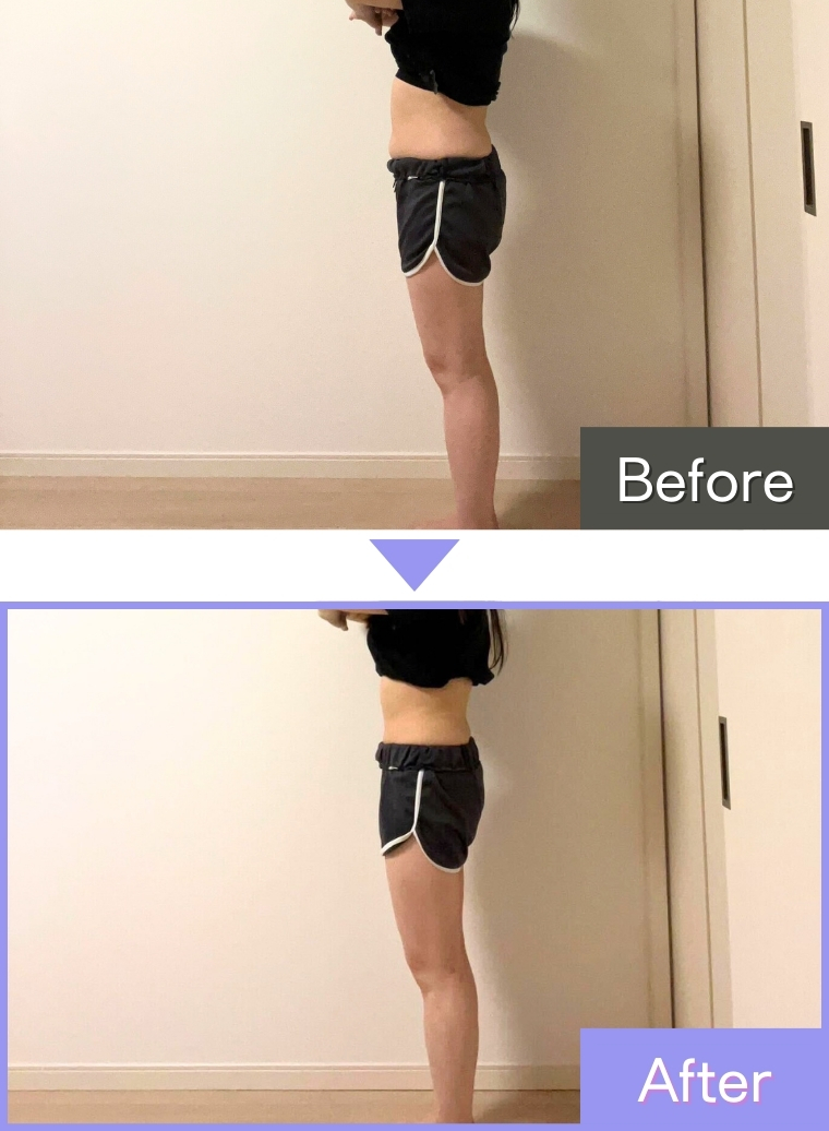 IEDEMOダイエット実施後の写真